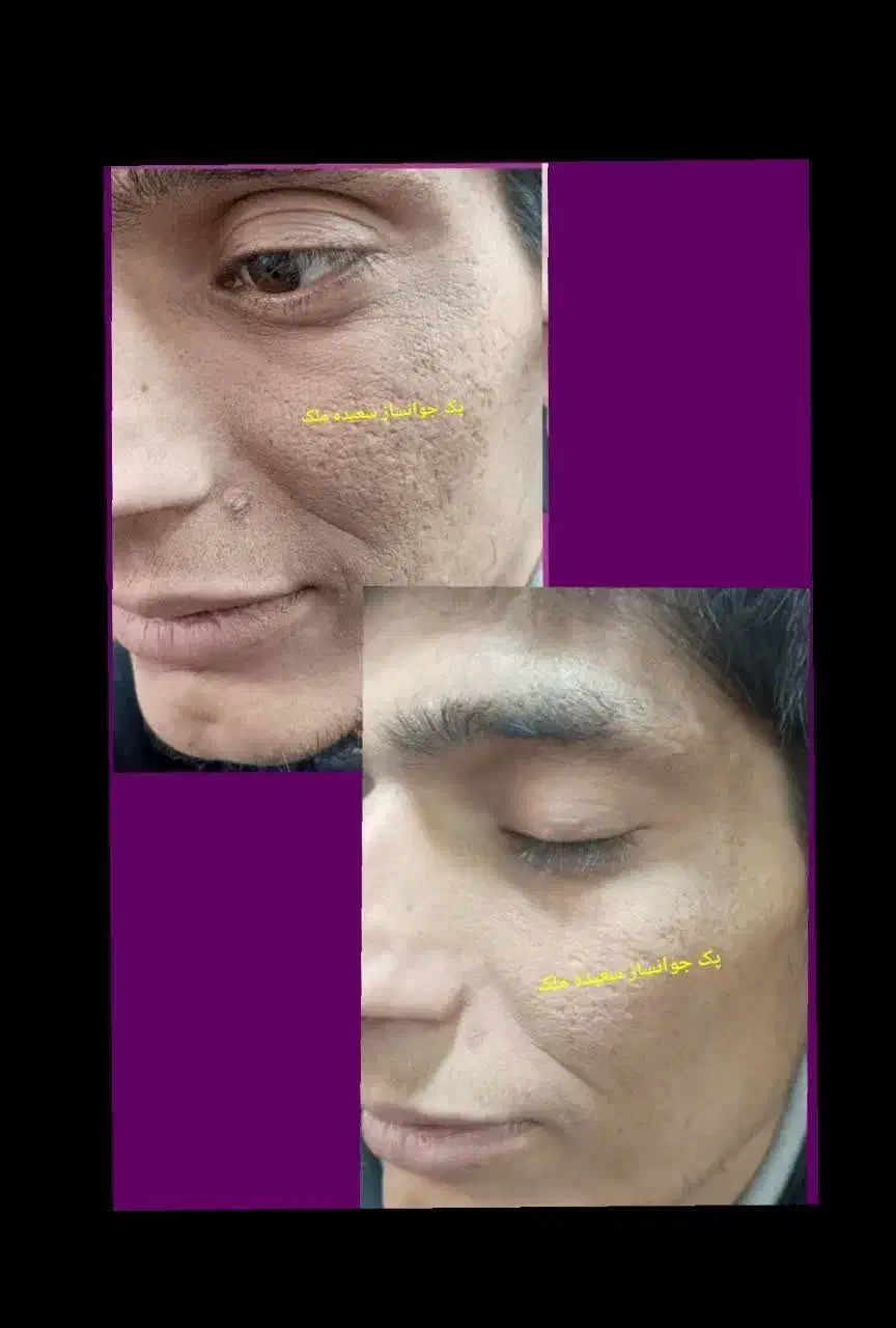 پک جوانساز بیست کاره سعیده ملک|آرایشی، بهداشتی، درمانی|بافق, |دیوار