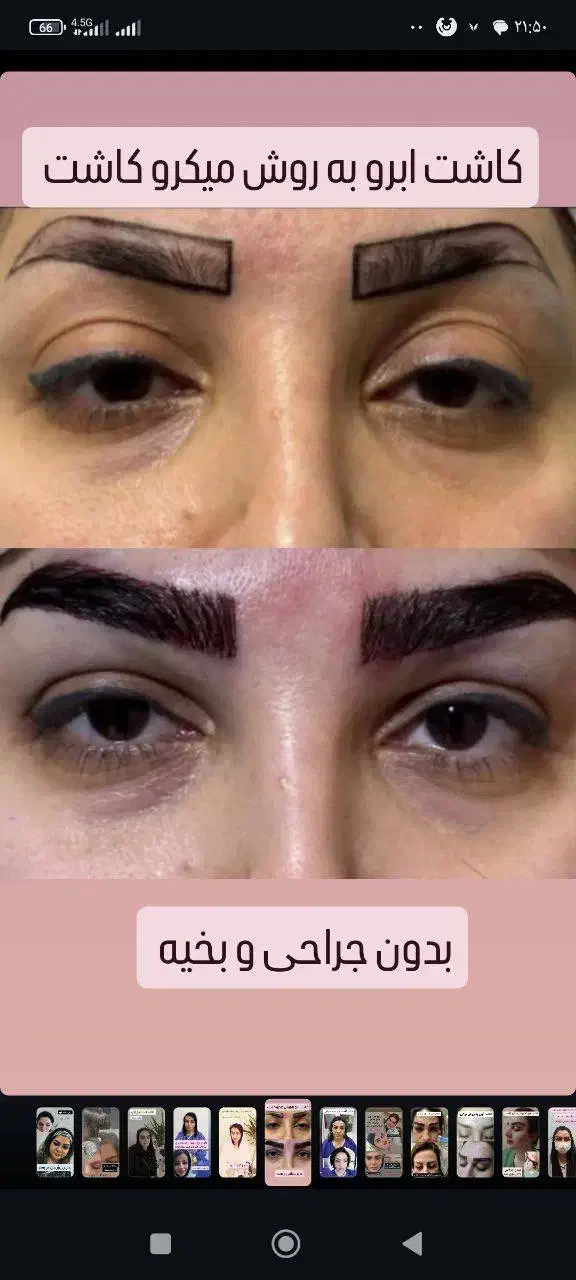 کاشت مووابروبه بدون جراحی ودردوبصورت اقساطی|خدمات آرایشگری و زیبایی|تبریز, |دیوار