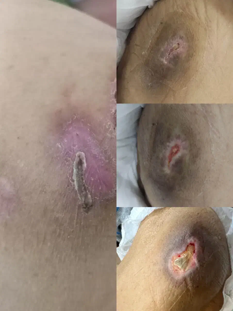 کلینیک تخصصی درمان زخم ( بستر و دیابت) فردوس|خدمات آرایشگری و زیبایی|اصفهان, بهار آزادی|دیوار