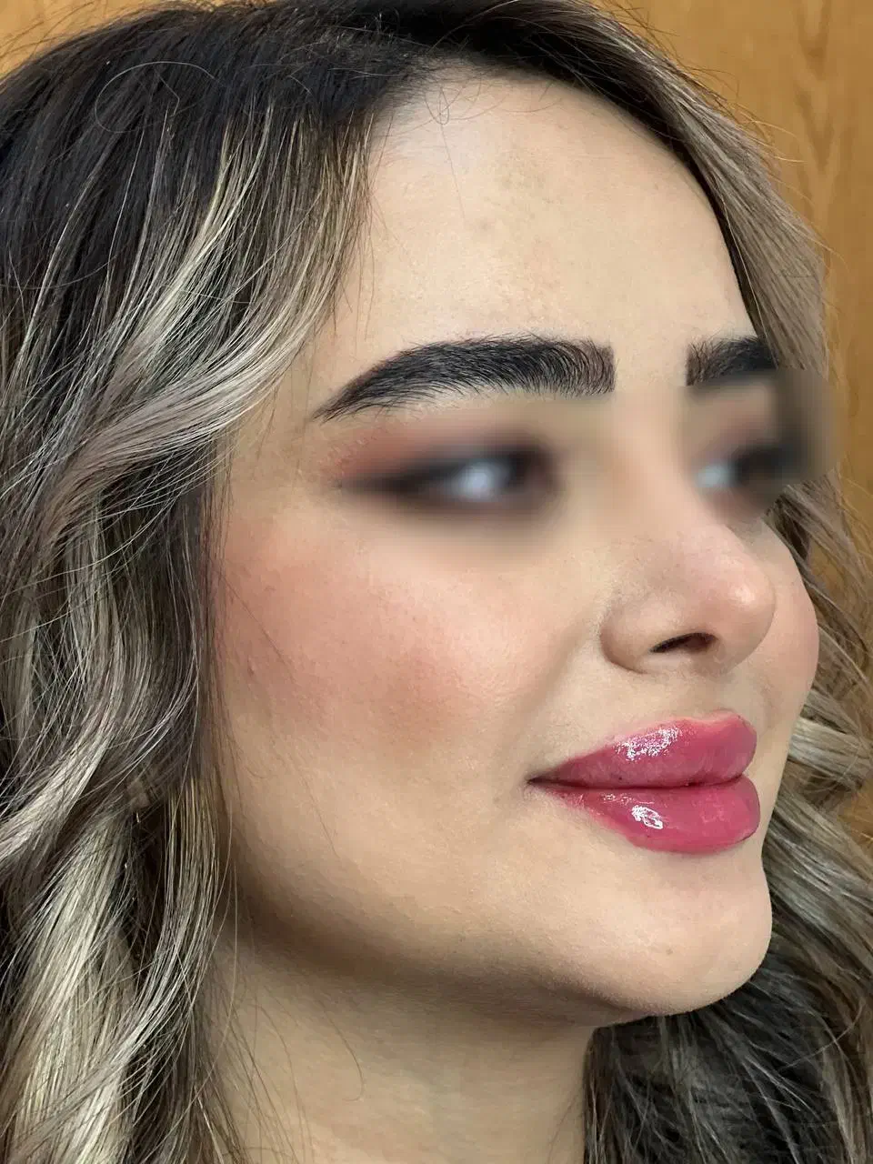 تزریق فیلر لب با متدهای ترند اینستا - دکتر واحدی|خدمات آرایشگری و زیبایی|قزوین, |دیوار