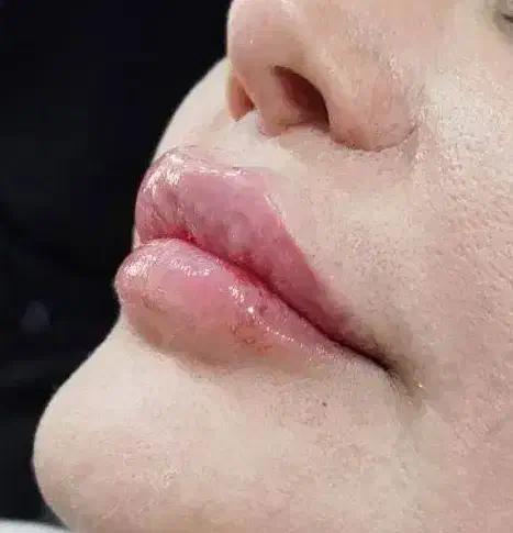 ژل سی سی۵۰۰ پرسینگ، چال گونه|خدمات آرایشگری و زیبایی|اهواز, کمپلو جنوبی|دیوار