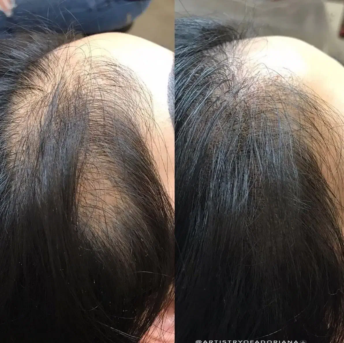 اسکالپ تراپی سر|خدمات آرایشگری و زیبایی|شاهین‌شهر, چمران|دیوار