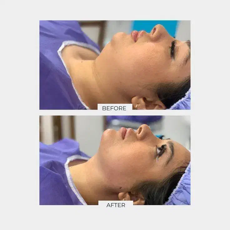 جراحی صورت ۵۰درصد تخفیف|خدمات آرایشگری و زیبایی|تهران, دروس|دیوار