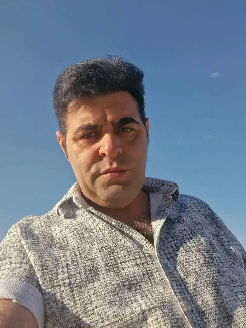 کاشت موی تخصصی تبریز|خدمات آرایشگری و زیبایی|اردبیل, |دیوار