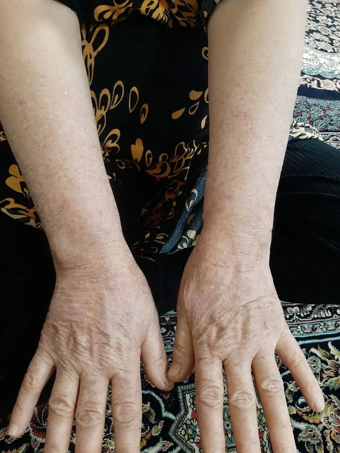 خال برداری|خدمات آرایشگری و زیبایی|دورود, |دیوار