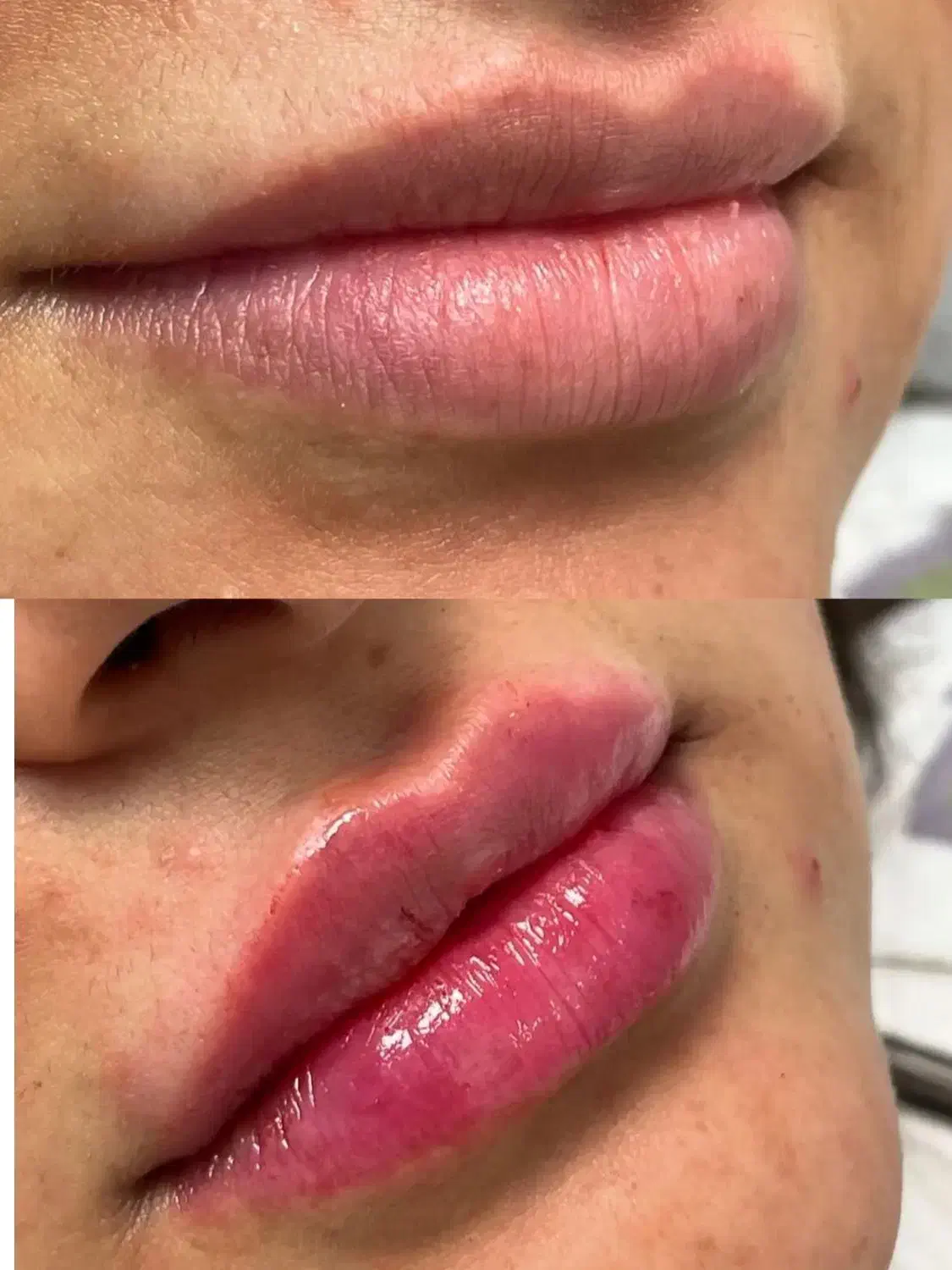 کلینیک زیبایی جراحی ژل بوتاکس غبغب فیلر لیزر مزو|خدمات آرایشگری و زیبایی|کرج, مهرویلا جنوبی|دیوار