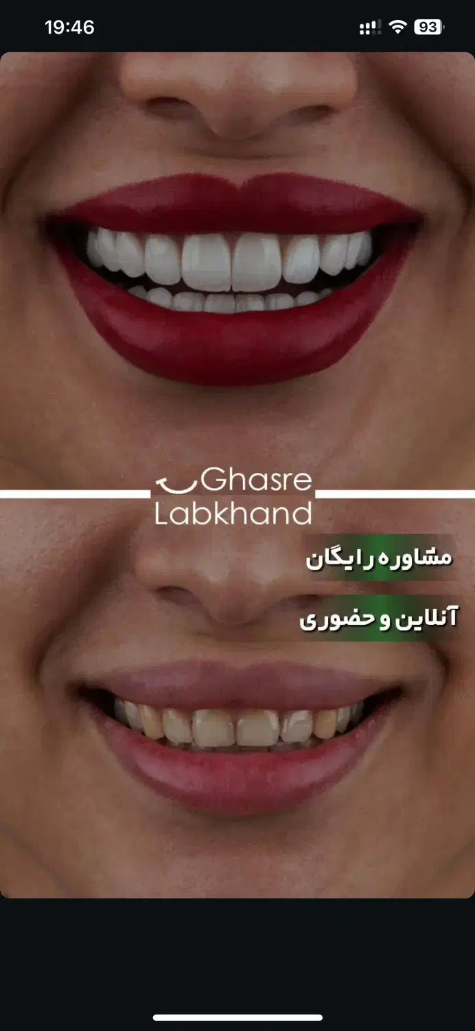 انجام انواع کامپوزیت کمترین قیمت با ۱۲ سال گارانتی|خدمات آرایشگری و زیبایی|تهران, زعفرانیه|دیوار