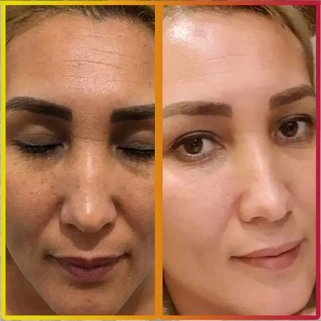 صورت|خدمات آرایشگری و زیبایی|بندر ترکمن, |دیوار