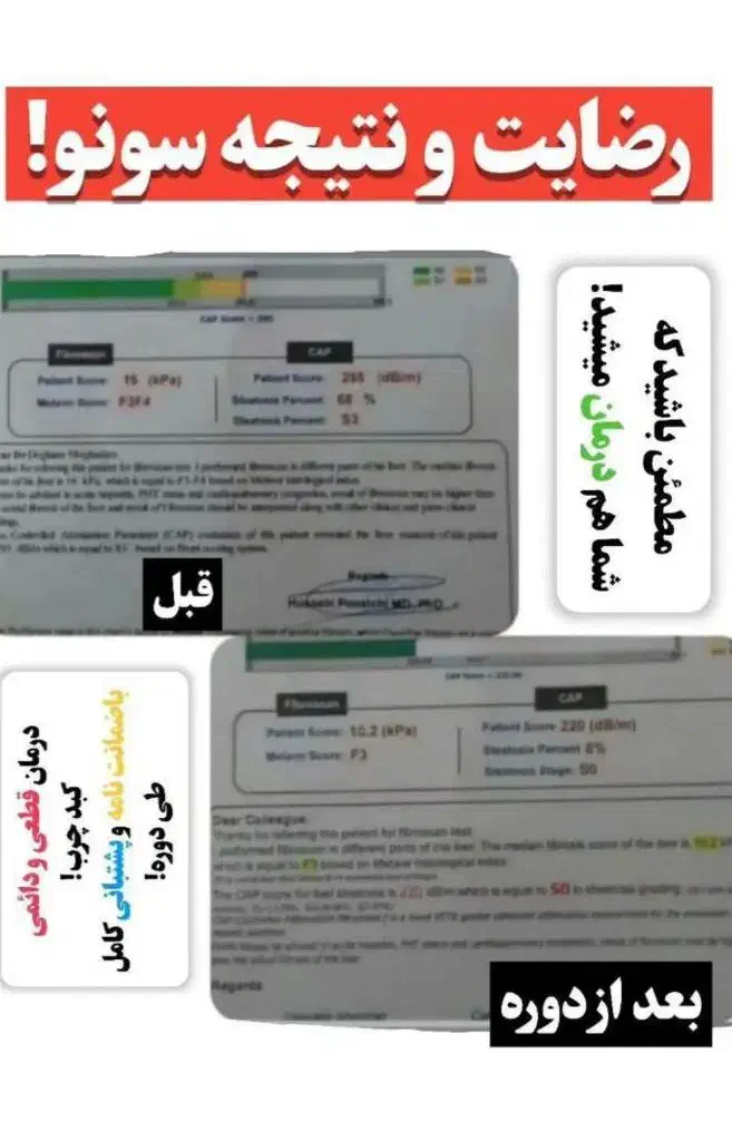 قند زیر 100 بدون قرص شیمیایی|خدمات آرایشگری و زیبایی|خرمشهر, |دیوار