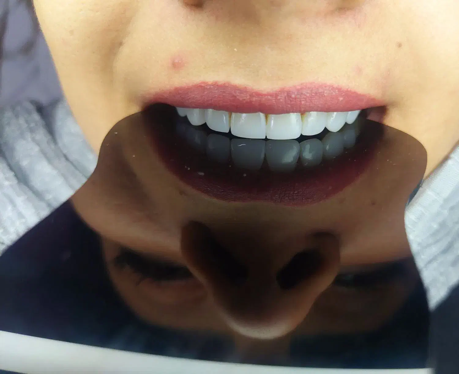 دنتال|خدمات آرایشگری و زیبایی|روانسر, |دیوار