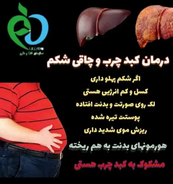 پاکسازی کبد چرب فقط در ۴۰ روز|آرایشی، بهداشتی، درمانی|گنبد کاووس, |دیوار