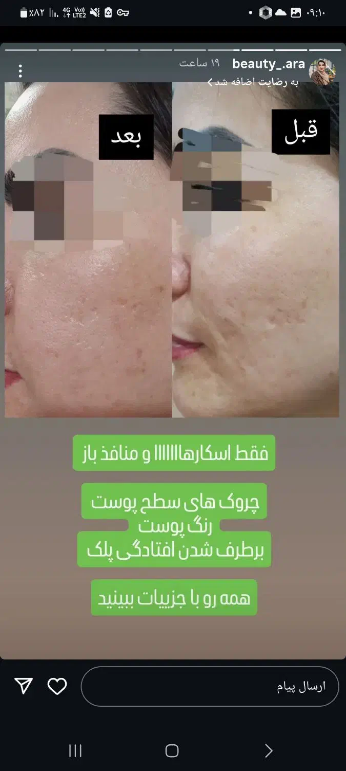 جوانساز|آرایشی، بهداشتی، درمانی|شیراز, ستارخان|دیوار