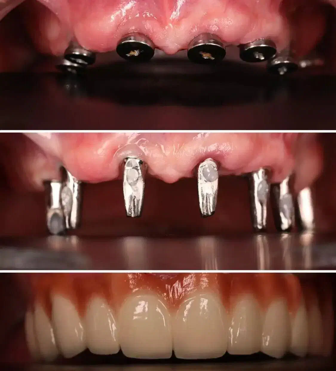 جشنواره دندانپزشکی ایمپلنت ۱۰/۳۰۰|خدمات آرایشگری و زیبایی|سلماس, |دیوار