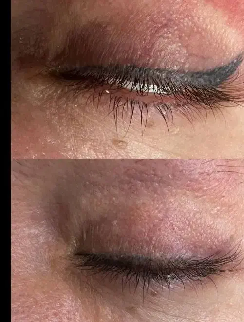 ریموو تخصصی تتوی ابرو و خط چشم و بدون آسیب|خدمات آرایشگری و زیبایی|بم, |دیوار