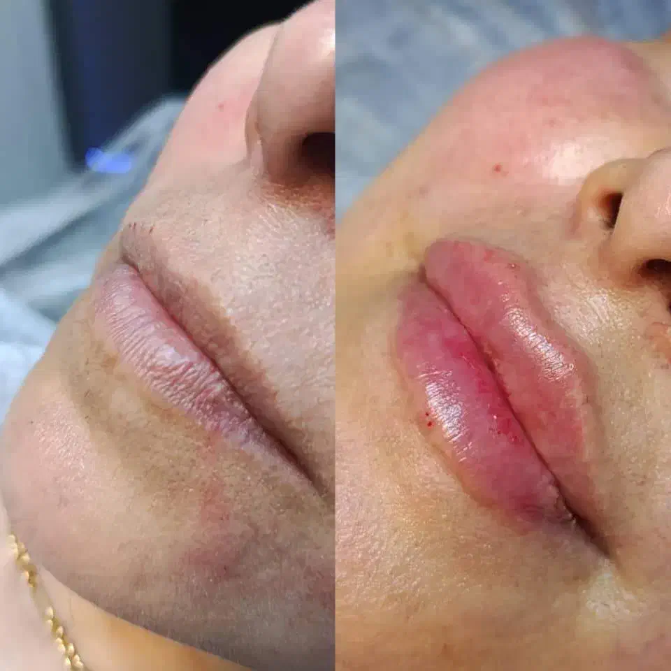 تخفیف ویژه خدمات ژل و بوتاکس|خدمات آرایشگری و زیبایی|اهواز, سپیدار|دیوار