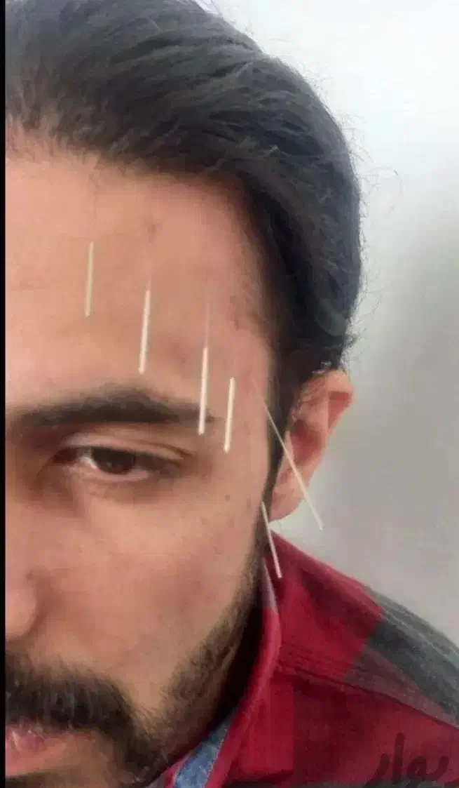 طب سوزنی،حجامت،زالو درمانی،تشخیص بیماری|خدمات آرایشگری و زیبایی|کرج, خرمدشت|دیوار