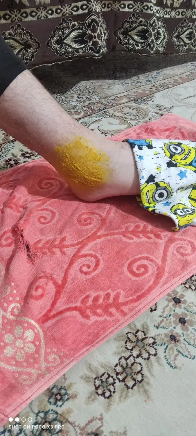 شکسته بندی|خدمات آرایشگری و زیبایی|مشهد, میعاد (شهرک غرب)|دیوار