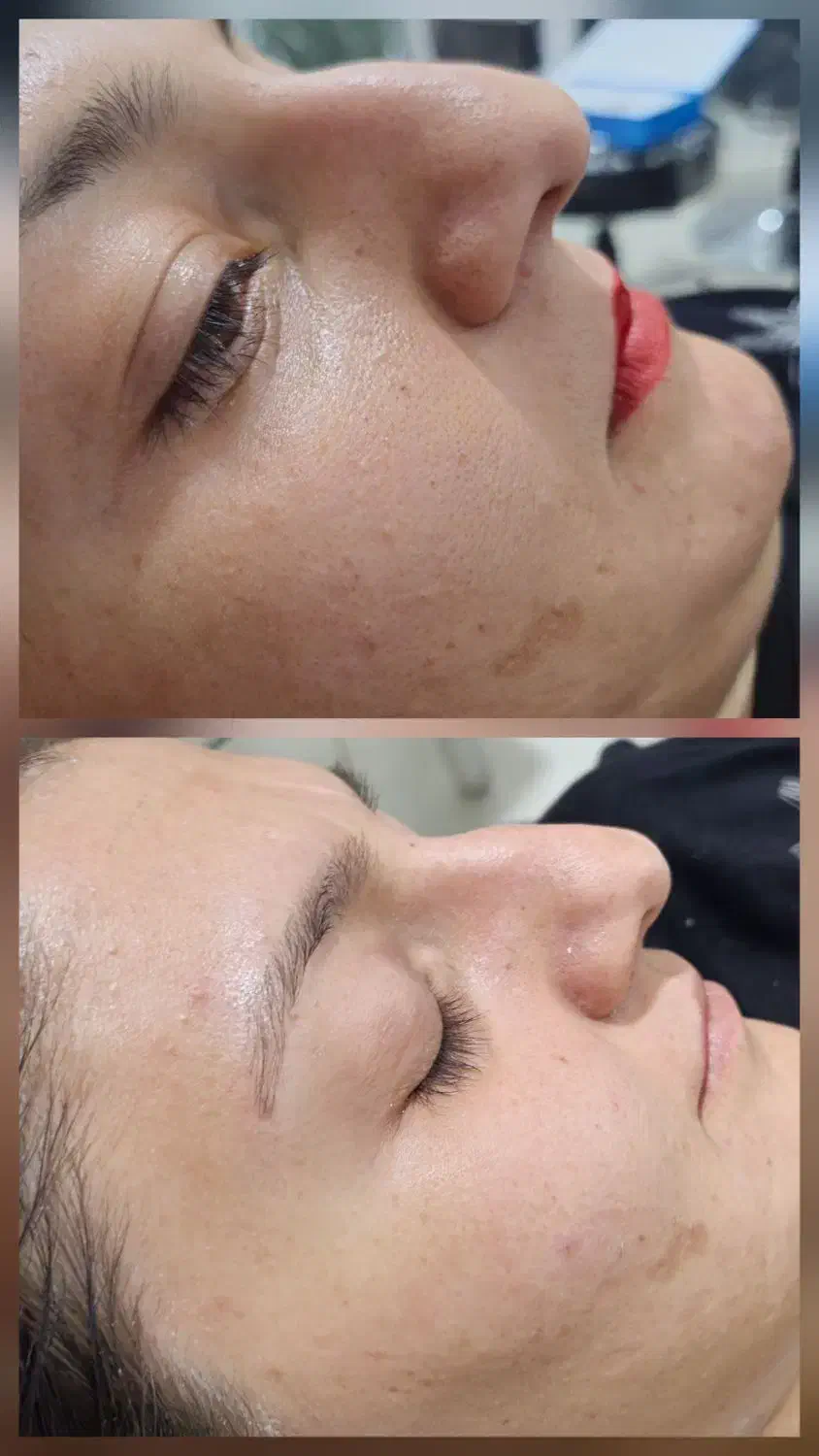 تخفیف در لاین فیشیال ومیکاپ|آرایشگاه و سالنهای زیبایی|زرند, |دیوار