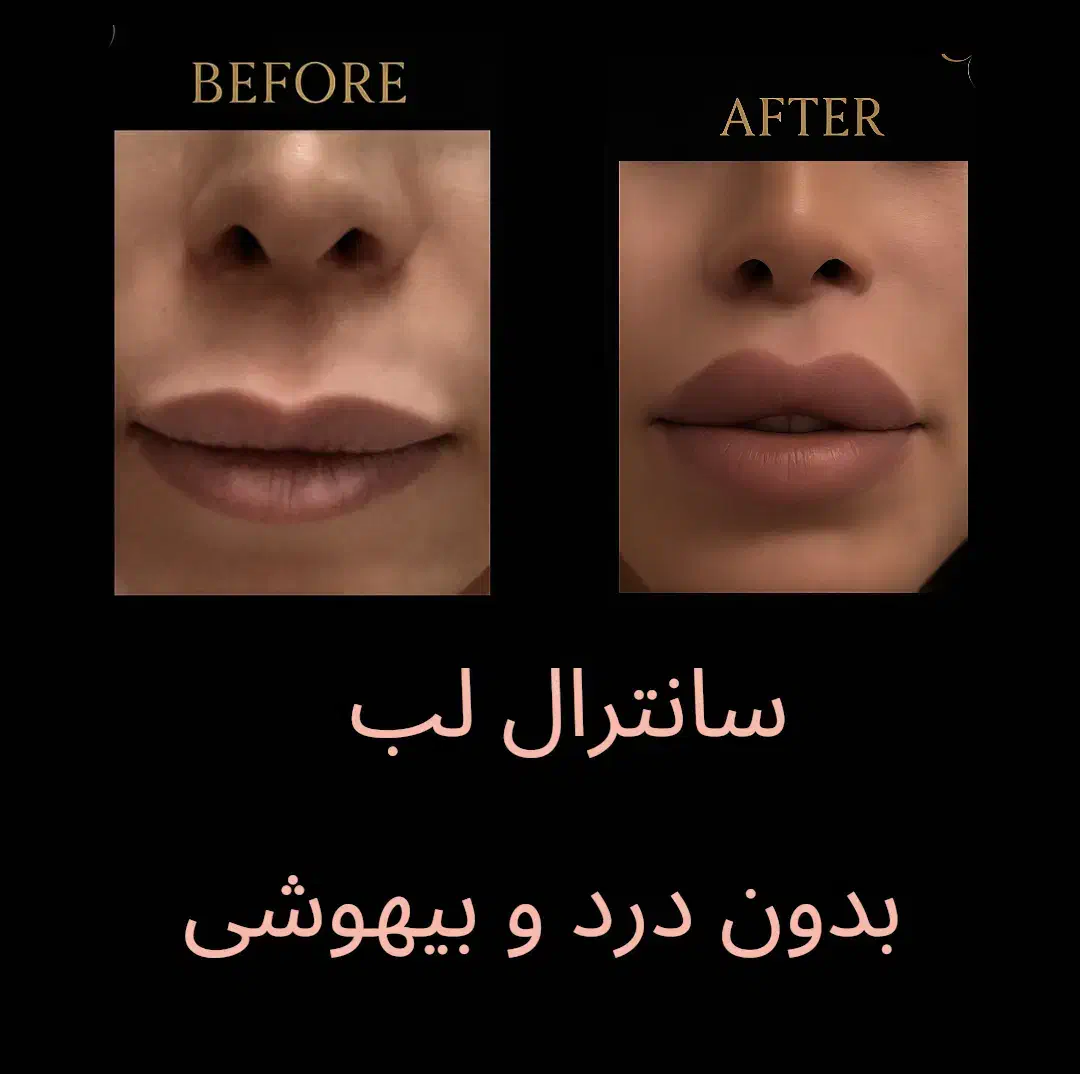 سانترال لب با تخفیف ویژه|خدمات آرایشگری و زیبایی|تهران, باغ فیض|دیوار