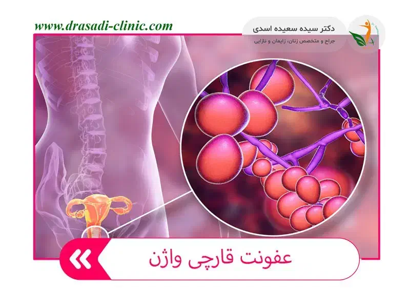 درمان طبیعی عفونت و سردی بدن بدون داروی شیمیایی|آرایشی، بهداشتی، درمانی|گنبد کاووس, |دیوار