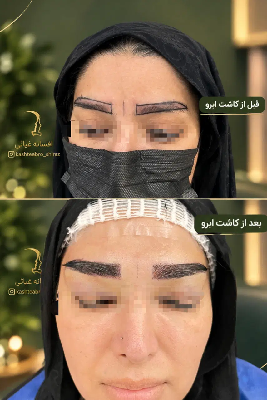 کاشت ابرو بصورت تمام اقساط|خدمات زیبایی و سلامت|شیراز, مهدیآباد|دیوار