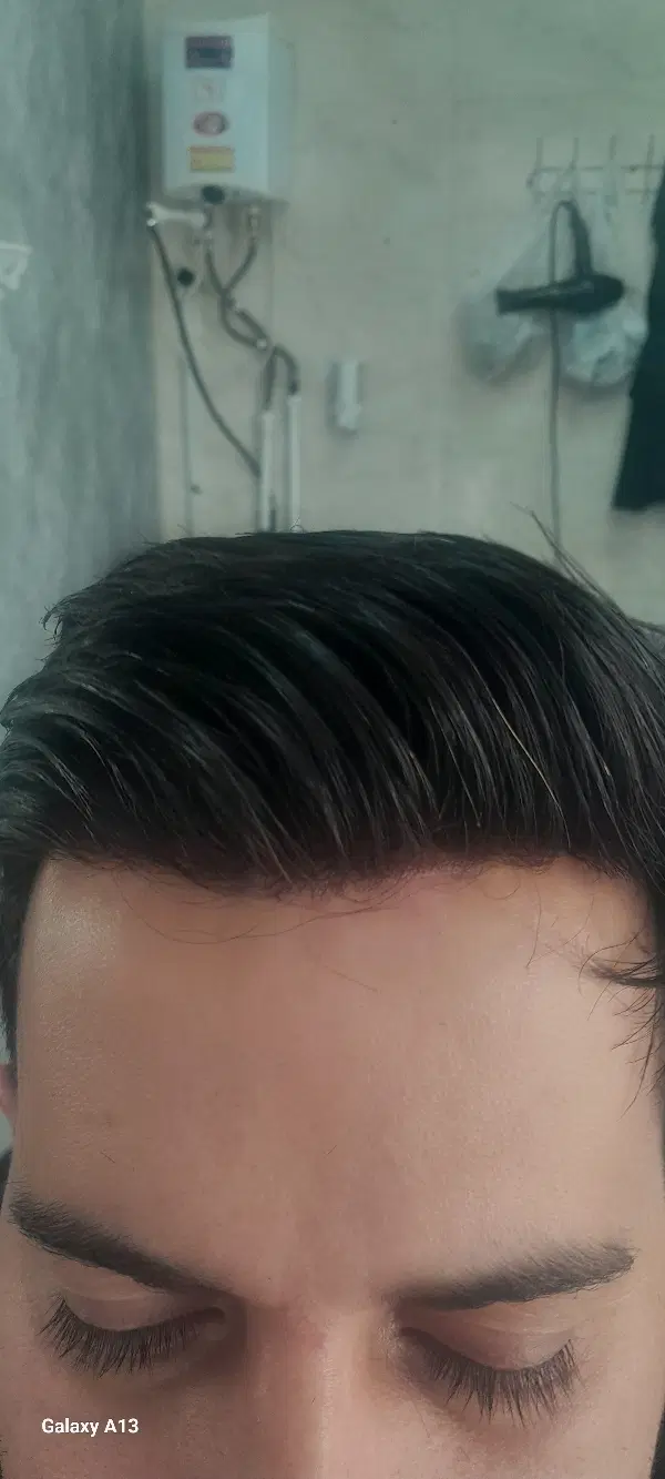 خدمات تخصصی پروتز مو در «ALI CUT»|خدمات زیبایی و سلامت|رشت, دیلمان|دیوار