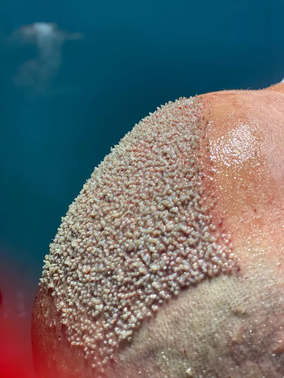 کاشت مو|خدمات آرایشگری و زیبایی|رشت, کاکتوس|دیوار