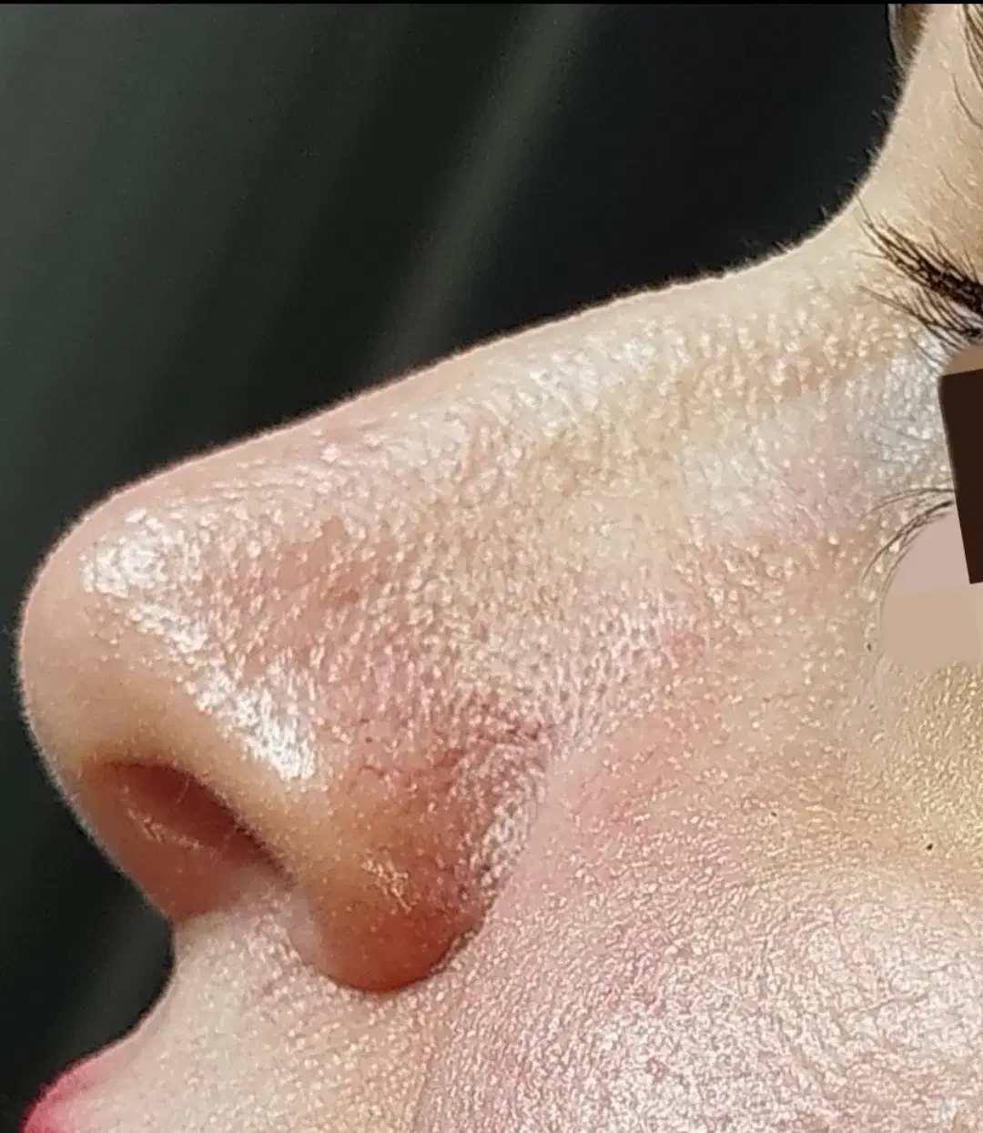 اصلاح فرم بینی بدون جراحی|خدمات آرایشگری و زیبایی|رشت, بلوار گیلان|دیوار