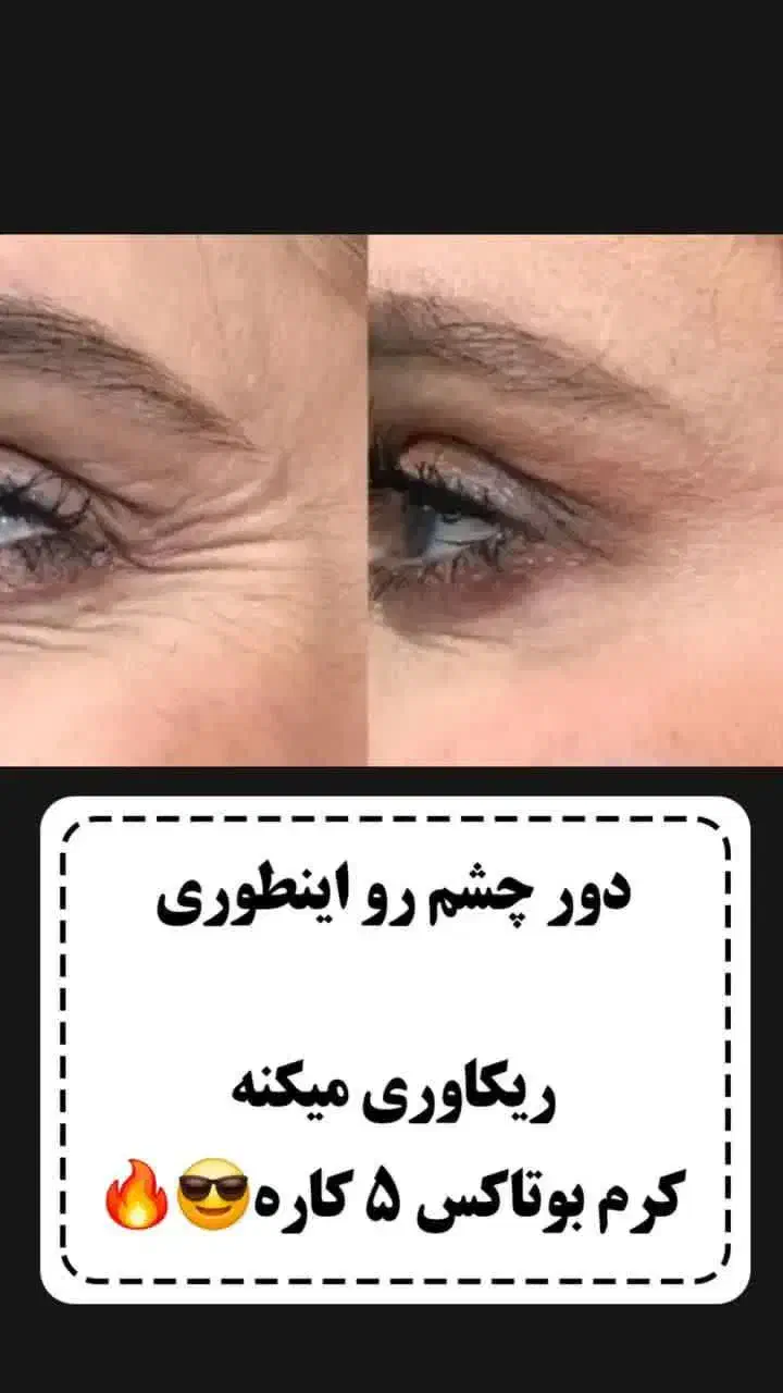 محصولات آرایشی کوین|آرایشی، بهداشتی، درمانی|اردبیل, |دیوار