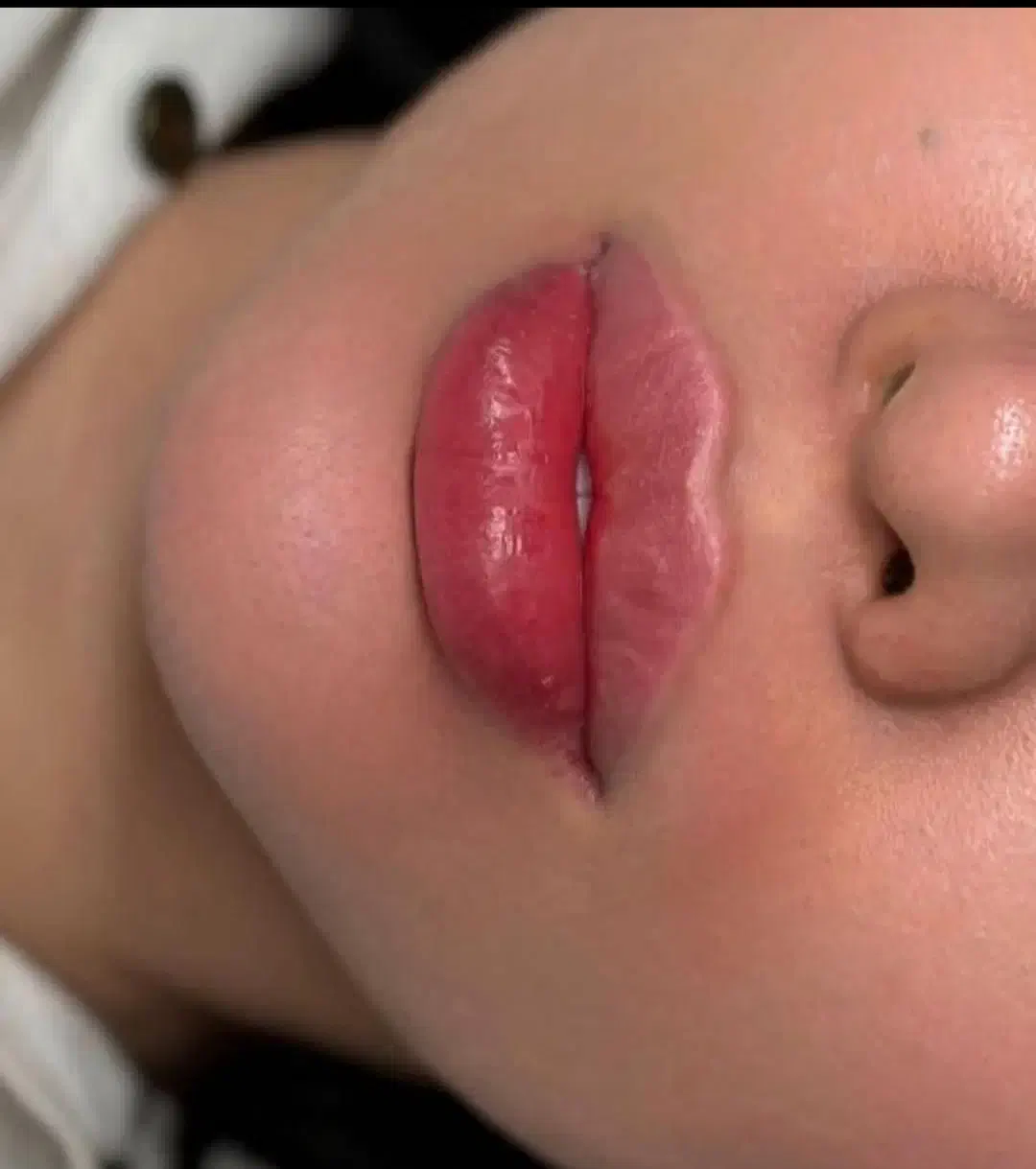 جشنواره ژل و بوتاکس|خدمات آرایشگری و زیبایی|کاشان, کشاورز|دیوار