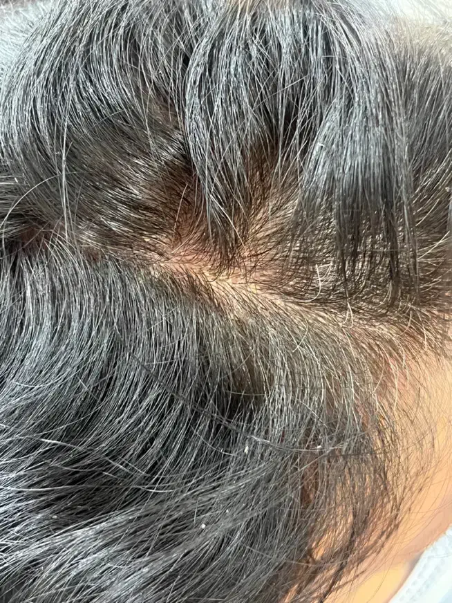 اسکراب و پاکسازی تخصصی کف سر /درخشش و رشد مو|خدمات آرایشگری و زیبایی|صدرا-فارس, فاز ۱|دیوار