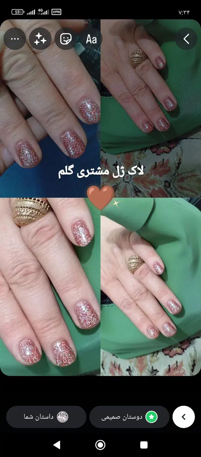 کاشت ناخن آموزش ناخن|خدمات آرایشگری و زیبایی|گلستان (تهران), |دیوار