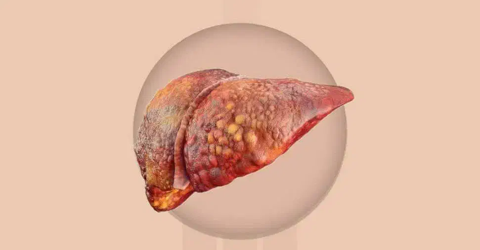 پکبچ بهبود دیابت|آرایشی، بهداشتی، درمانی|بندرعباس, |دیوار