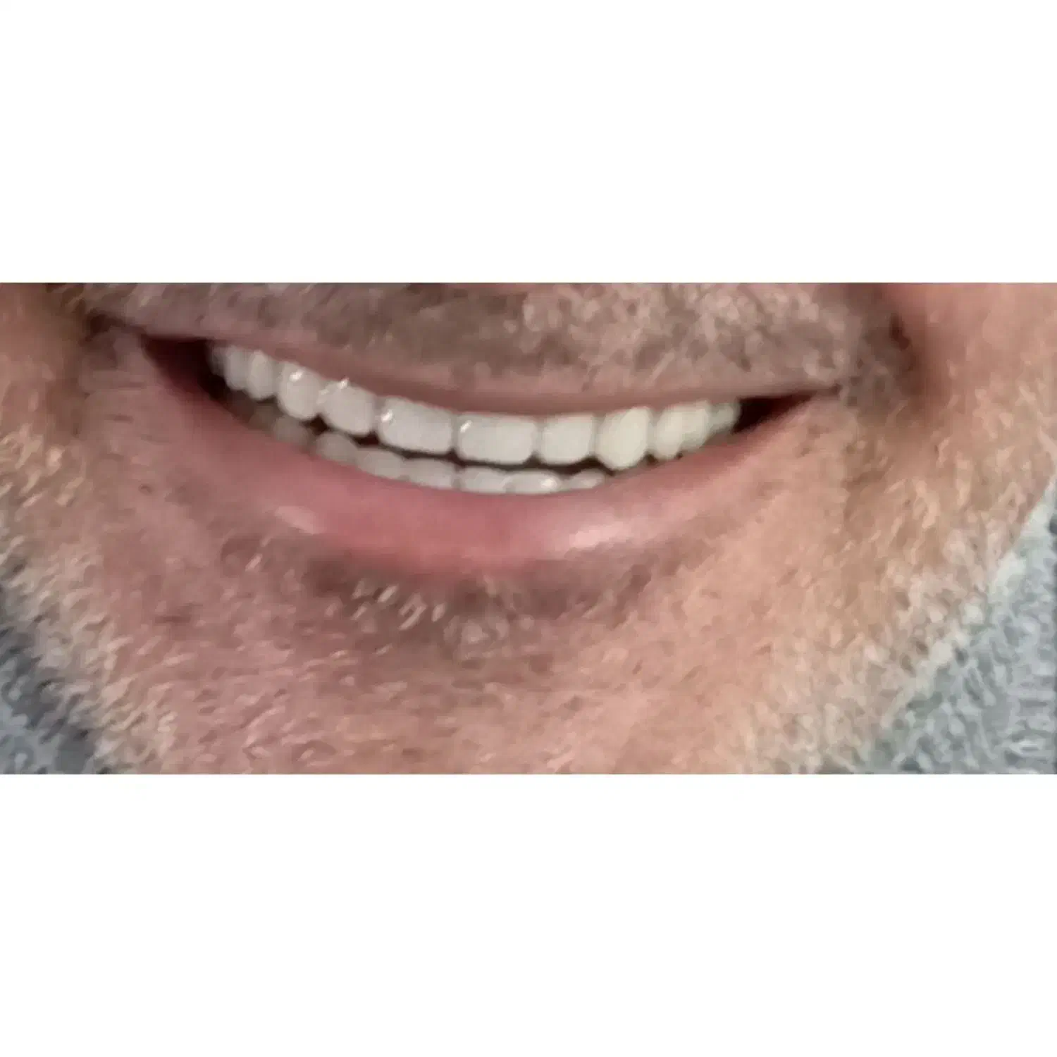 دندانسازی|آرایشی، بهداشتی، درمانی|جغتای, |دیوار