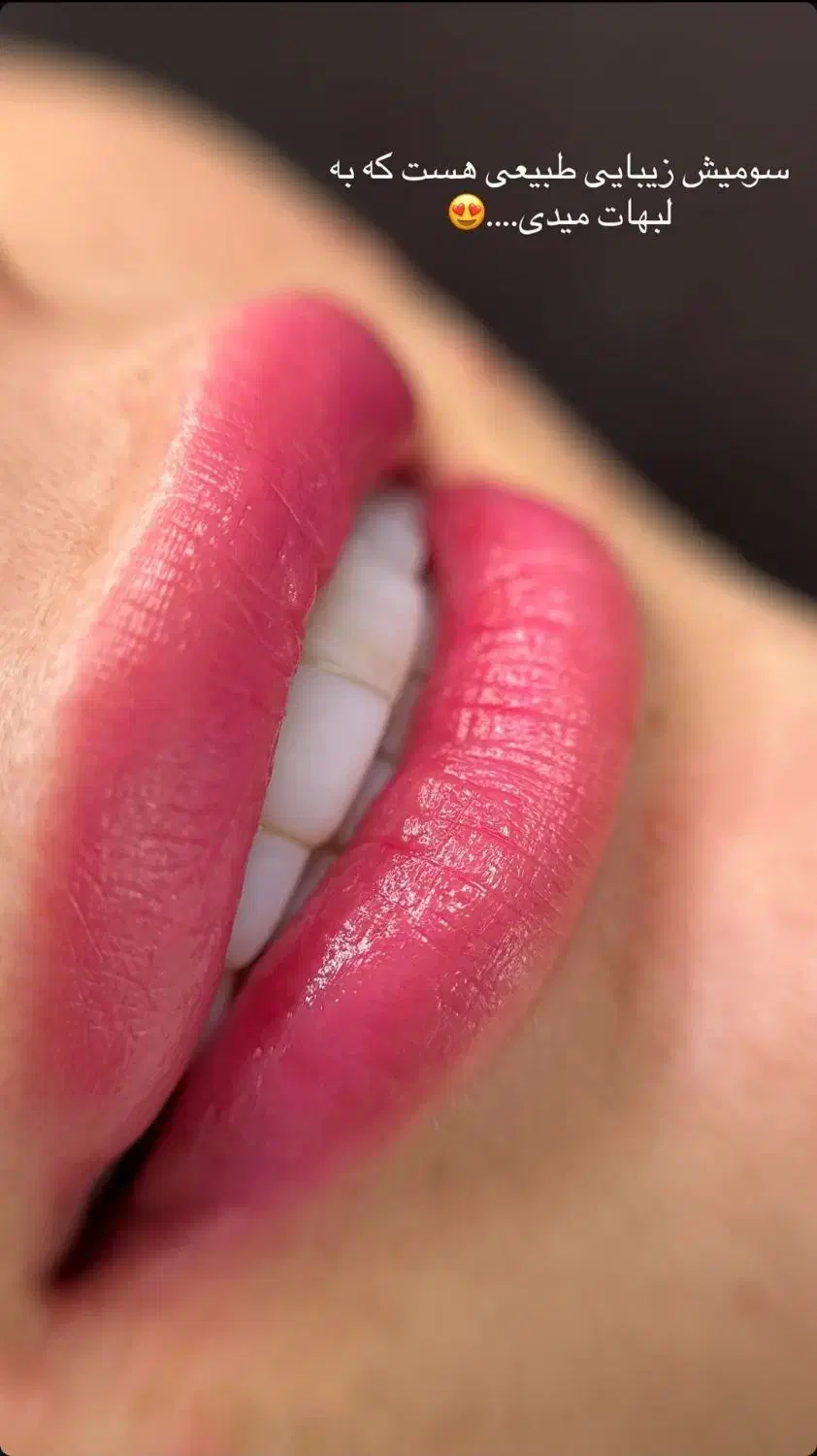 آرایش دائم میکرو ابرو شید لب ریموو تاتو های قدیمی|خدمات آرایشگری و زیبایی|قائمشهر, |دیوار