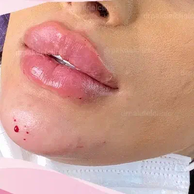 تخفیف ویژه شب یلدا خدمات زیبایی|خدمات آرایشگری و زیبایی|مشهد, کوشش|دیوار