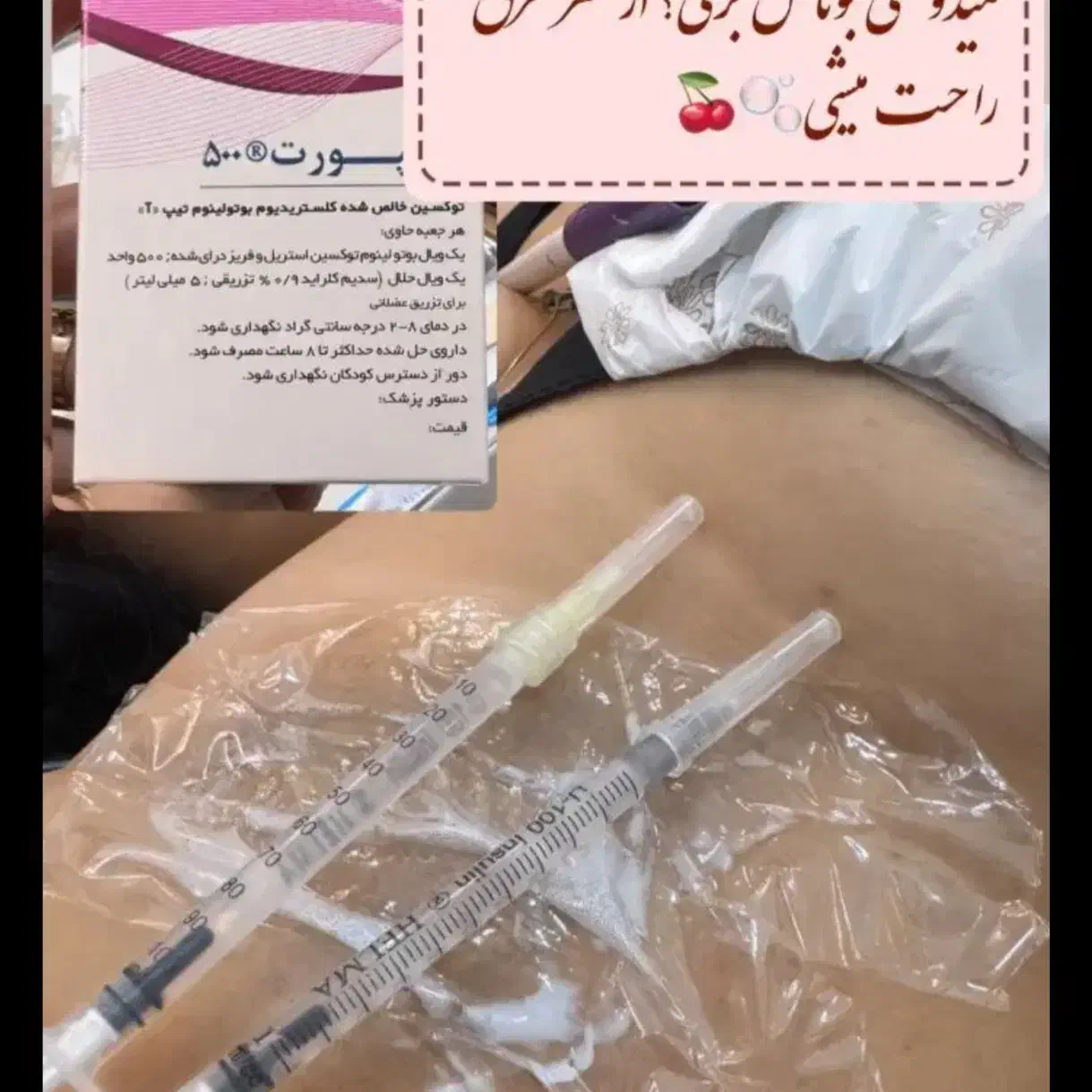 مدل ژل وبوتاکس|خدمات آرایشگری و زیبایی|اهواز, فاز ۲ پادادشهر|دیوار