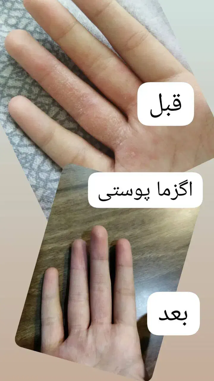 درمان معجزه گر|آرایشی، بهداشتی، درمانی|شاهینشهر, فردوسی|دیوار