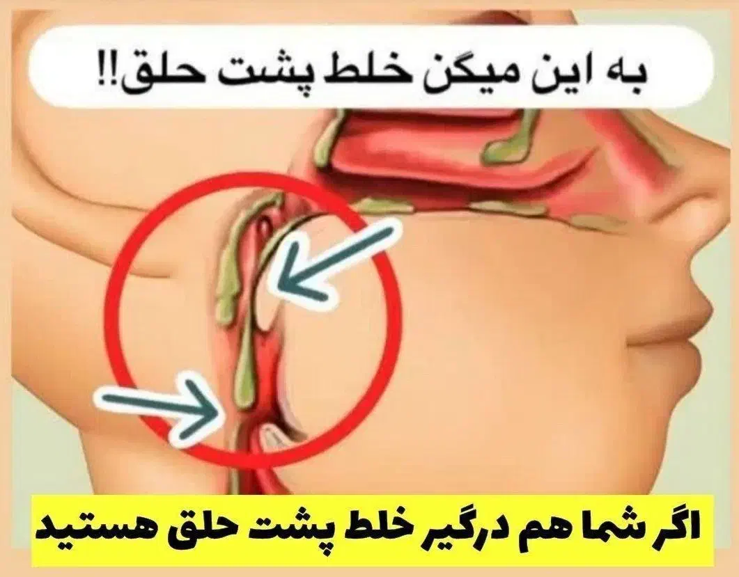 درمان بلغم/خلط پشت حلق/اگزما /اصلاح مزاج/گوارشی|آرایشی، بهداشتی، درمانی|فیروزکوه, |دیوار