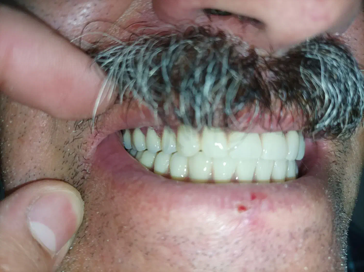 لابراتوار دندانسازی، دندان مصنوعی|آرایشی، بهداشتی، درمانی|تبریز, |دیوار