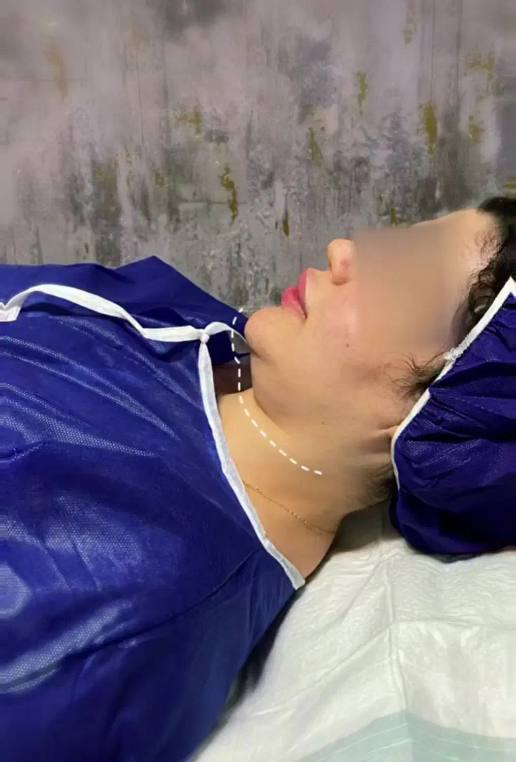 ساکشن غبغب|خدمات آرایشگری و زیبایی|یاسوج, |دیوار