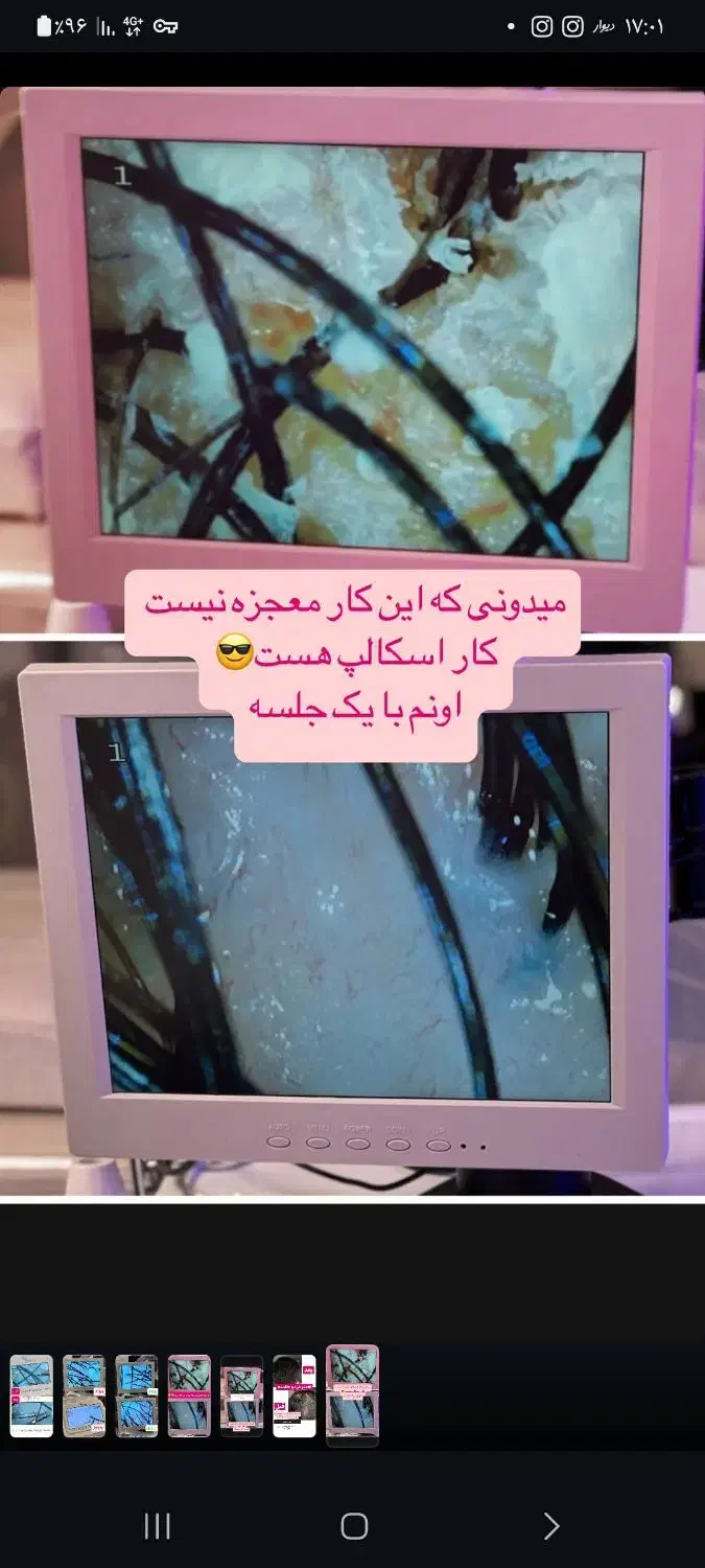 درمان تخصصی ریزش مو و رفع کم پشتی مو|خدمات آرایشگری و زیبایی|قم, صدوق|دیوار