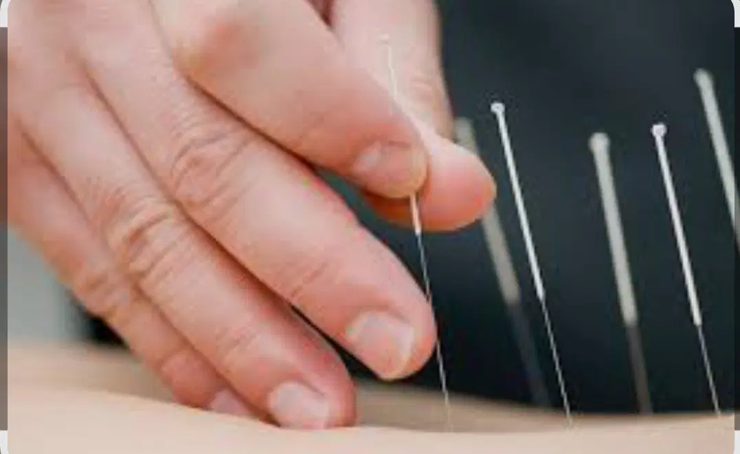 طب سنتی زالو درمانی طب سوزنی شکسته بندی ماساژ|خدمات زیبایی و سلامت|تبریز, |دیوار