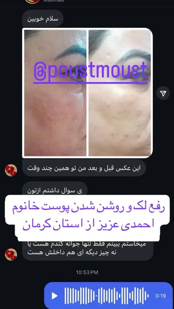 کرم زد لک 8کاره لاکچری کوین|آرایشی، بهداشتی، درمانی|برازجان, |دیوار