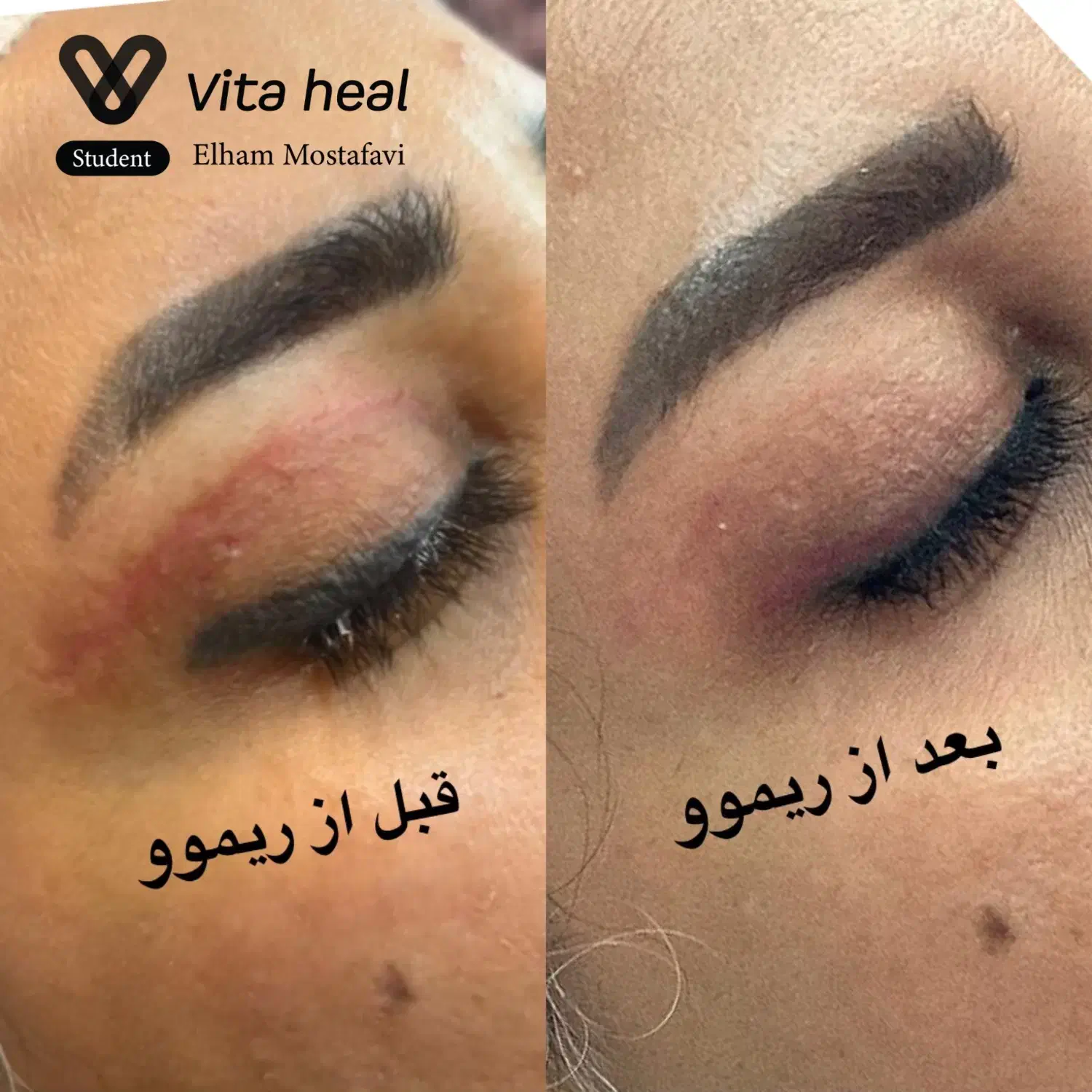 جشنواره یلدایی ریموو تخصصی تتو ابرو چشم و لب|خدمات آرایشگری و زیبایی|شیراز, تندگویان|دیوار