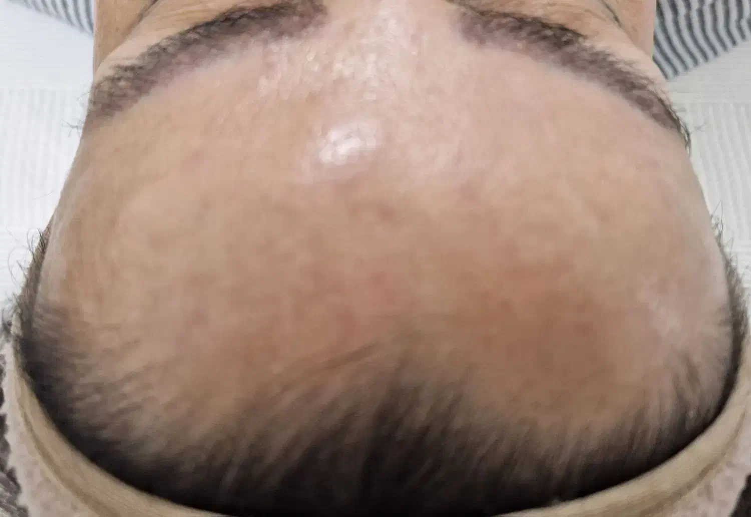 فیشال درمانی تخصصی|خدمات آرایشگری و زیبایی|بندر ماهشهر, |دیوار