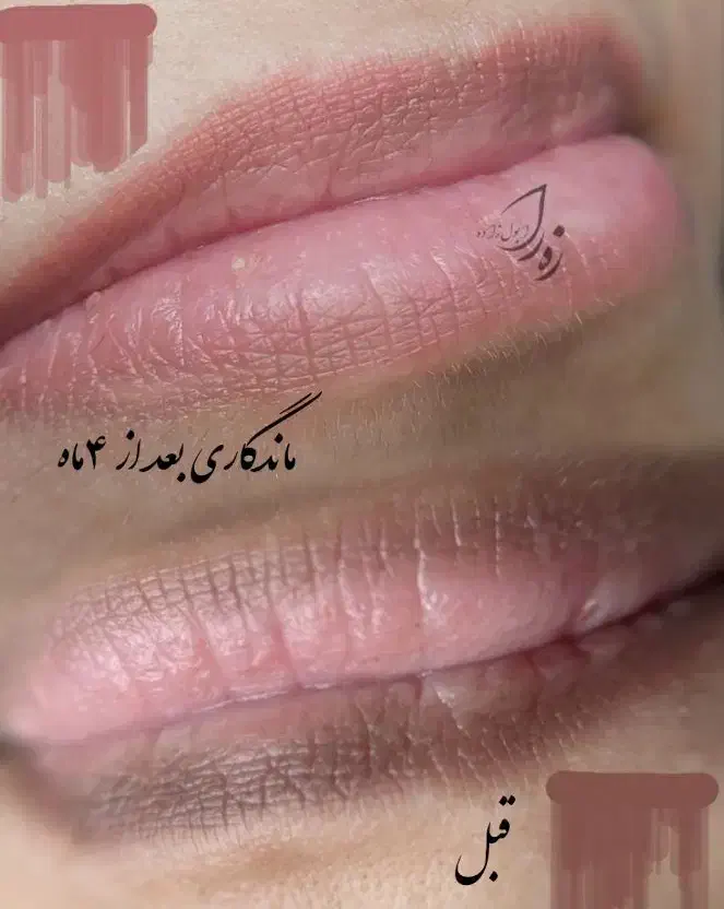 مدل برای رفع تیرگی و بدرنگی لب + میکرو ابرو|خدمات آرایشگری و زیبایی|اهواز, کوروش|دیوار