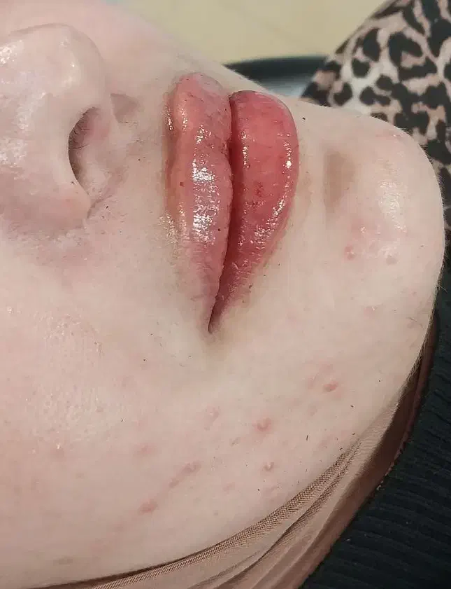 تزریق فیلر و بوتاکس لیفت نخ مزو و...|خدمات آرایشگری و زیبایی|مشهد, گلشور|دیوار