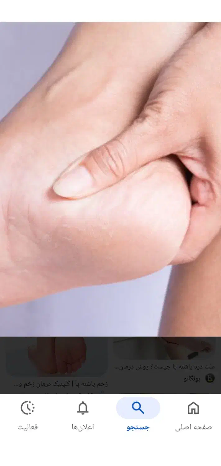 راهنمایی در مورد خار پاشنه|فعالیت داوطلبانه|ماهیدشت, |دیوار