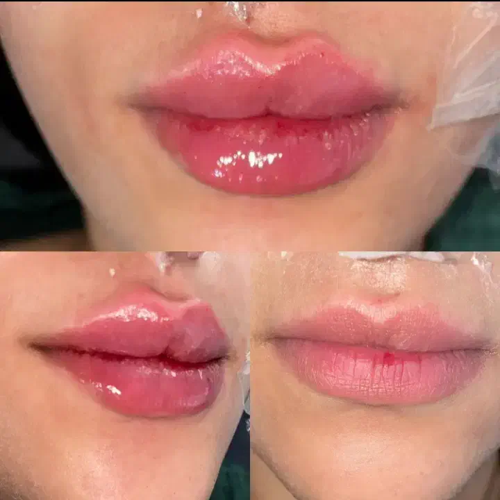 جشنواره تزریق ژل بوتاکس فیلر پی آرپی مطب زیبایی|خدمات آرایشگری و زیبایی|تبریز, |دیوار